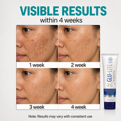 Skin Lightening Cream