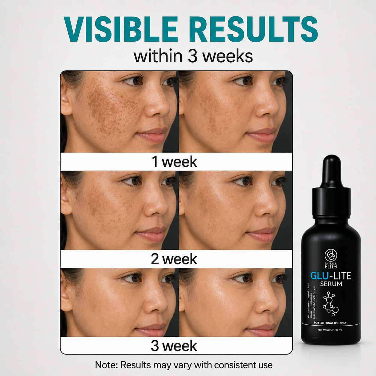 Tranexamic acid Serum