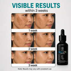 Tranexamic acid Serum
